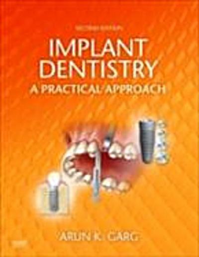 Implant Dentistry - E-Book