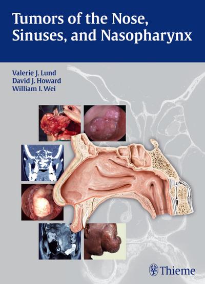 Tumors of the Nose, Sinuses and Nasopharynx