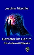 Gewitter im Gehirn