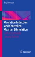 Ovulation Induction and Controlled Ovarian Stimula