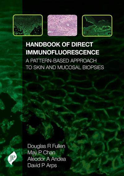 Handbook of Direct Immunofluorescence