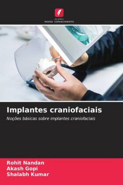 Implantes craniofaciais