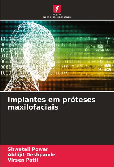 Implantes em próteses maxilofaciais