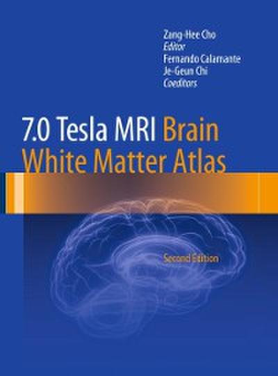 7.0 Tesla MRI Brain White Matter Atlas