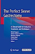 The Perfect Sleeve Gastrectomy
