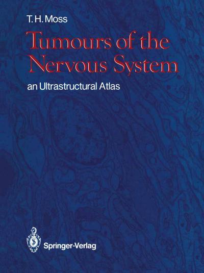 Tumours of the Nervous System