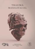 Trauma maxilofacial