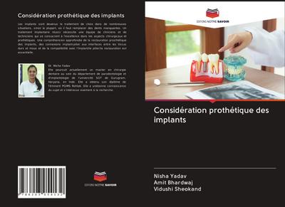 Considération prothétique des implants