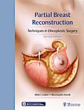 Partial Breast Reconstruction