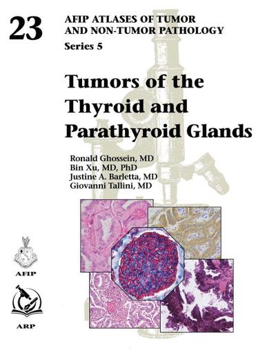Xu, B: Tumors of the Thyroid and Parathyroid Glands