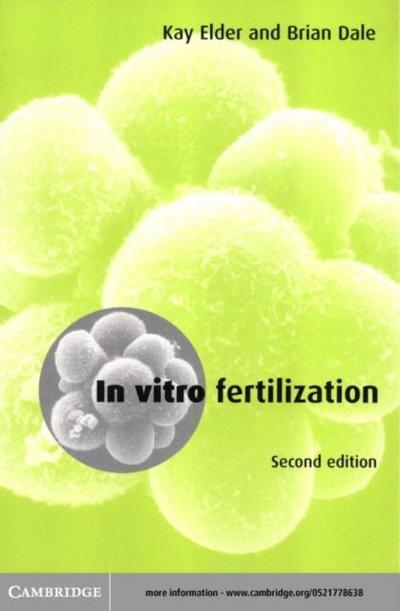 In Vitro Fertilization