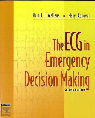 The ECG in Emergency Decision Making