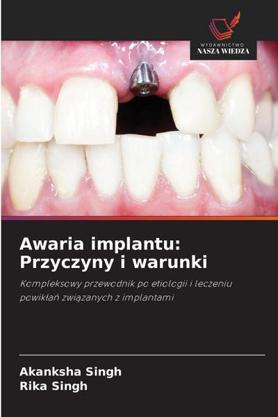 Awaria implantu: Przyczyny i warunki