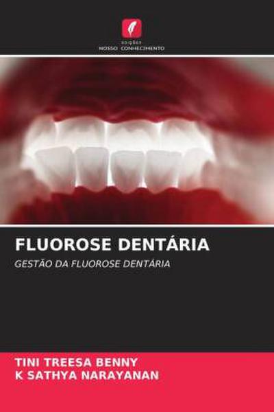FLUOROSE DENTÁRIA