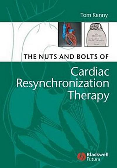 Nuts and Bolts of Cardiac
