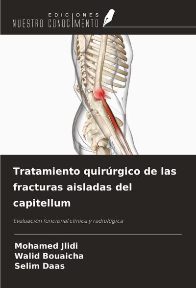 Tratamiento quirúrgico de las fracturas aisladas del capitellum