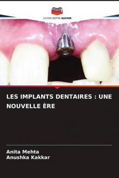 LES IMPLANTS DENTAIRES : UNE NOUVELLE ÈRE