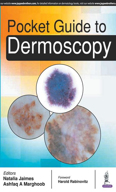 Pocket Guide to Dermoscopy