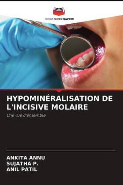 HYPOMINÉRALISATION DE L’INCISIVE MOLAIRE