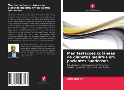 Manifestações cutâneas de diabetes mellitus em pacientes suadenses