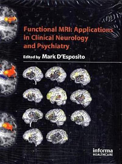 Functional MRI