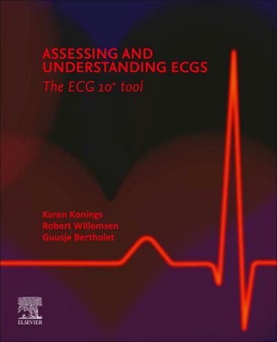 Assessing and Understanding Ecgs: The Ecg10+ Tool