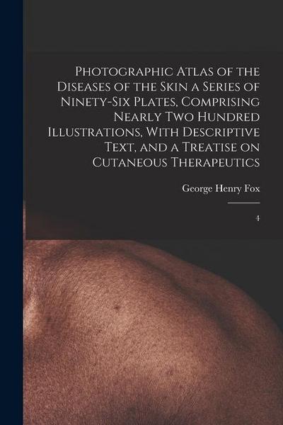 Photographic Atlas of the Diseases of the Skin a Series of Ninety-six Plates, Comprising Nearly two Hundred Illustrations, With Descriptive Text, and