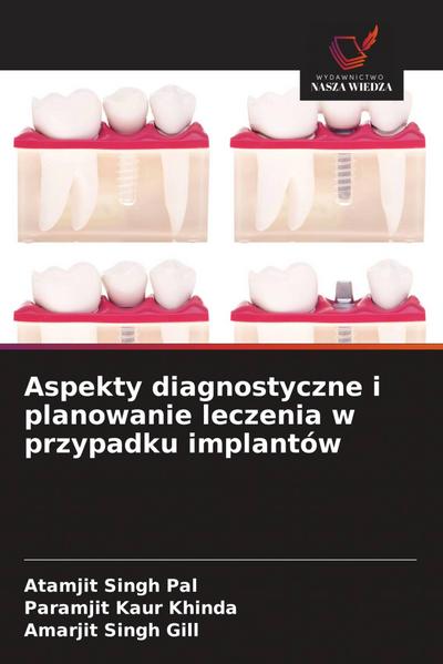 Aspekty diagnostyczne i planowanie leczenia w przypadku implantów
