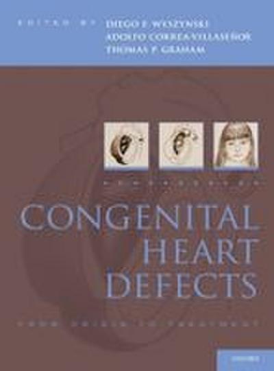 Congenital Heart Defects
