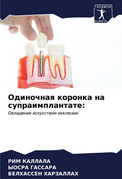 Odinochnaq koronka na supraimplantate: