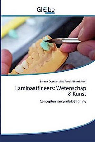 Laminaatfineers: Wetenschap & Kunst