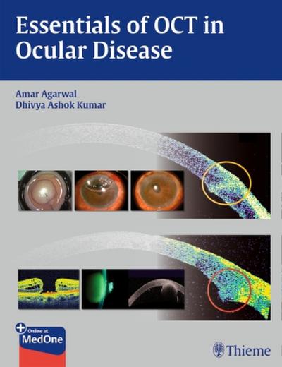 Essentials of Oct in Ocular Disease