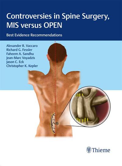 Controversies in Spine Surgery, MIS versus OPEN