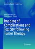 Imaging of Complications and Toxicity following Tu
