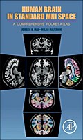 Human Brain in Standard Mni Space