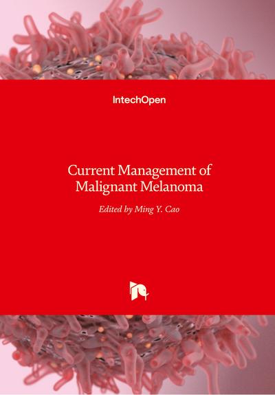 Current Management of Malignant Melanoma