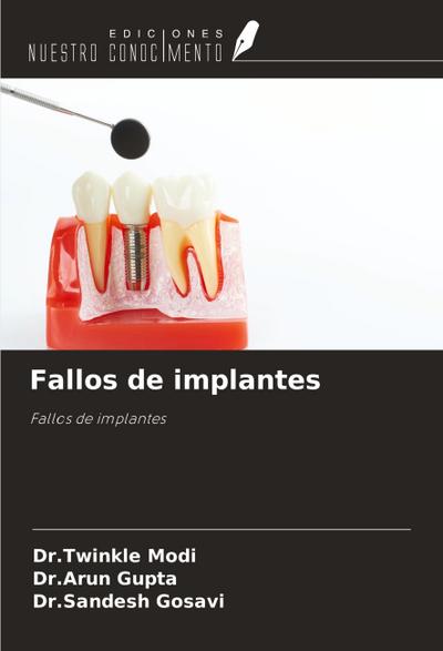 Fallos de implantes