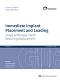 Immediate Implant Placement and Loading – Single or Multiple Teeth Requiring Replacement