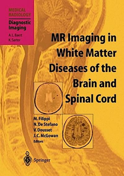 MR Imaging in White Matter Diseases of the Brain and Spinal Cord