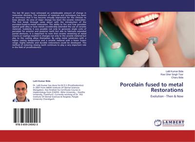 Porcelain fused to metal Restorations