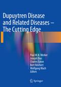 Dupuytren Disease and Related Diseases - The Cutti