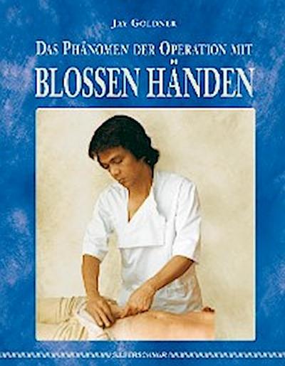 Das Phänomen der Operation mit blossen Händen