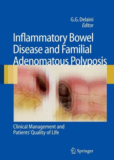 Inflammatory Bowel Disease and Familial Adenomatous Polyposis