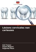 Lésions cervicales non carieuses
