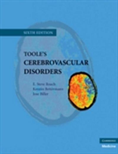 Toole’s Cerebrovascular Disorders