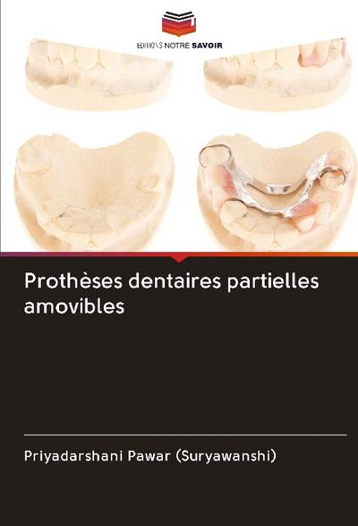Prothèses dentaires partielles amovibles