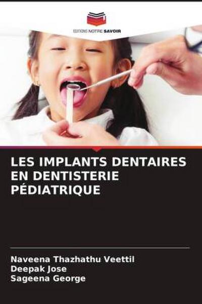 LES IMPLANTS DENTAIRES EN DENTISTERIE PÉDIATRIQUE