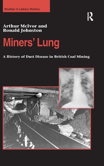 Miners’ Lung
