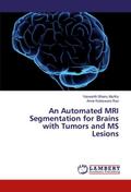 An Automated MRI Segmentation for Brains with Tumo