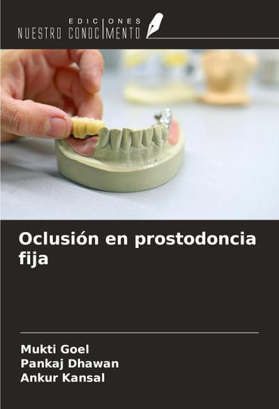 Oclusión en prostodoncia fija